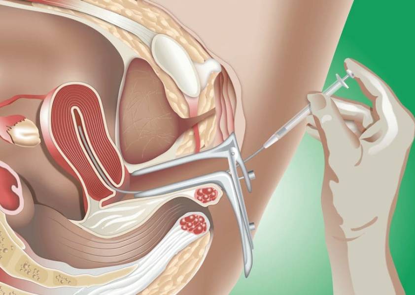 IUI Treatment Centre in Hinjewadi