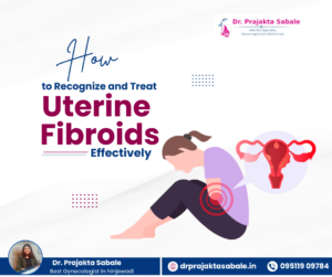 Uterine Fibroids Treatment